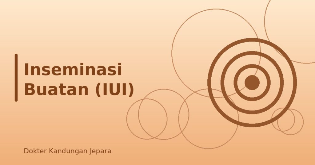 Inseminasi Buatan (IUI)