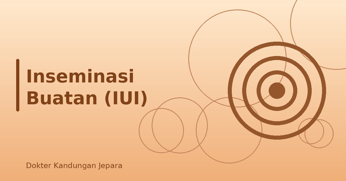 Inseminasi Buatan (IUI)